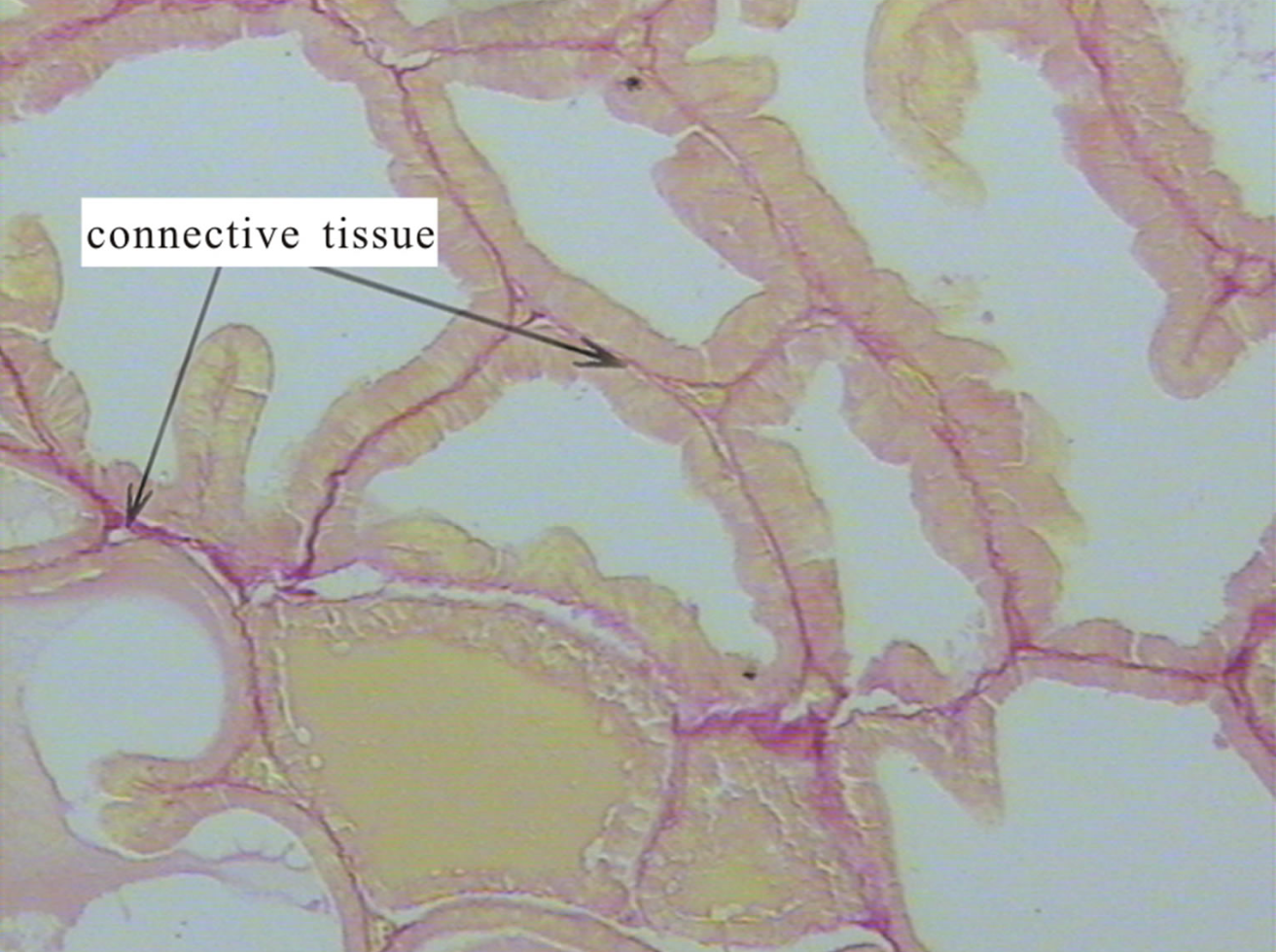 Prostamax: Prostate ƒe L&atilde;mesẽ me l&eacute;le ɖe asi